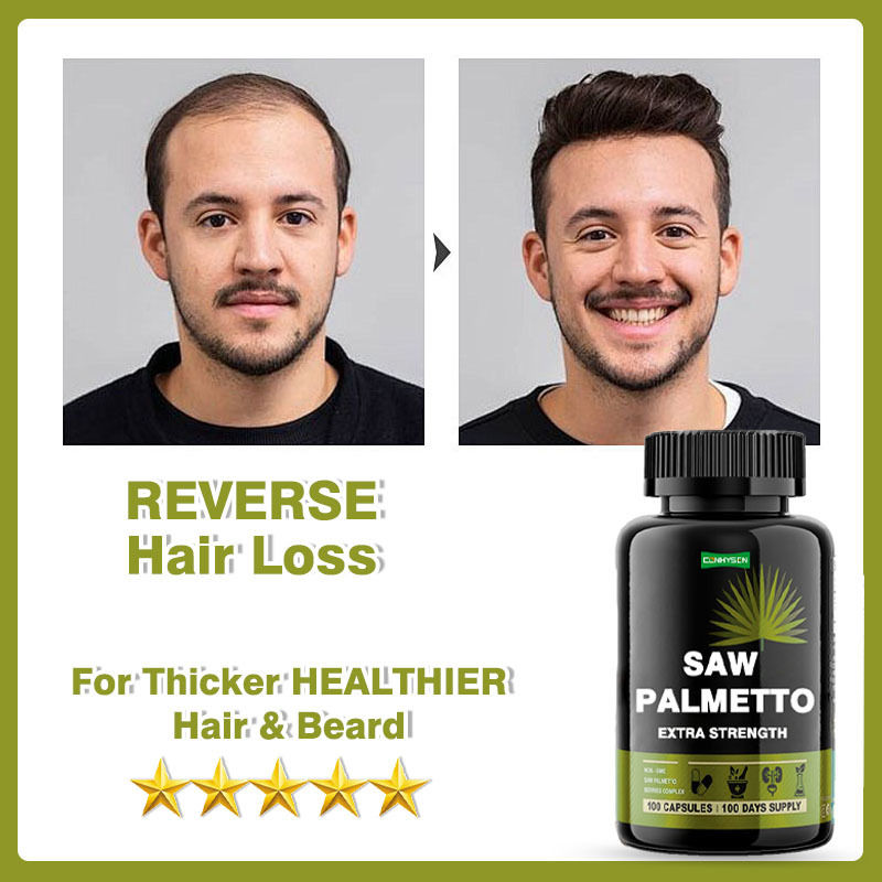 Supplement Manufacturer Saw Palmetto Capsules Extra Strength For Reduces Hair Loss Supports Growth