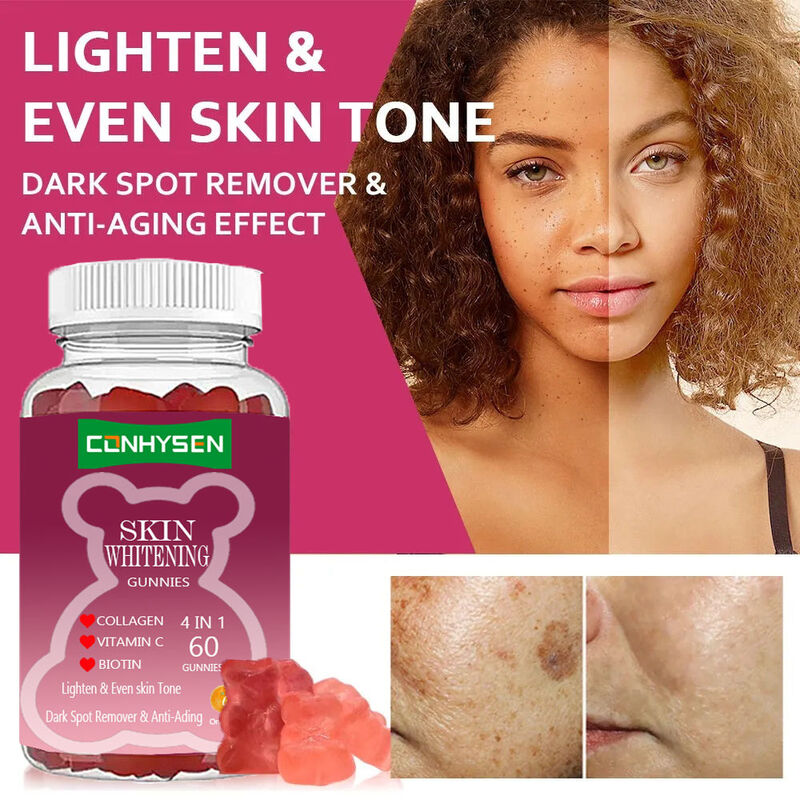 Best Skin Whitening Gummies Lightening & Even Skin Tone Gummies Remove Dark Spots Biotin Collagen Gummies